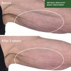 Retinal Resculpt Body Treatment