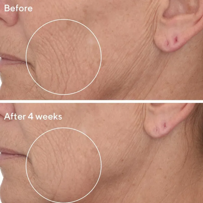 Retinal ReSculpt™ Overnight Treatment