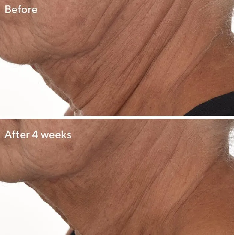 Retinal ReSculpt™ Overnight Treatment