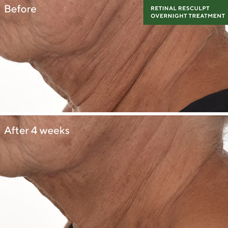 Retinal ReSculpt™ Overnight Treatment