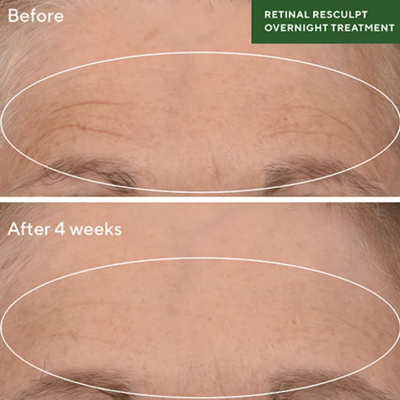 Retinal ReSculpt™ Overnight Treatment