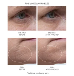 Retinol Fusion PM