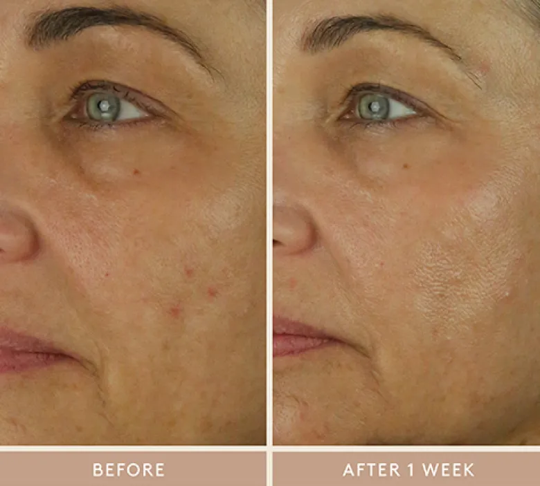 Retinol Reform with 1% Encapsulated Retinol