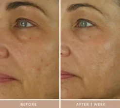 Retinol Reform with 1% Encapsulated Retinol
