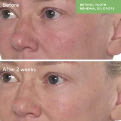 Retinol Youth Renewal Oil Drops