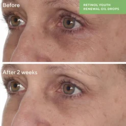 Retinol Youth Renewal Oil Drops