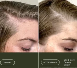 Scalp Care Density Serum