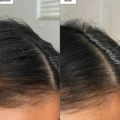 Scalp Revival™ Charcoal + Tea Tree Buildup Detox Spray