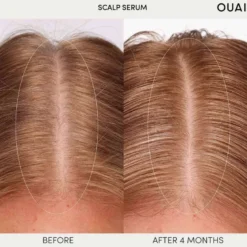 Scalp Serum