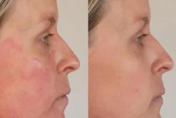 Signature Nourishing Facial Mask