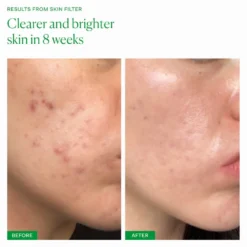 Skin Filter