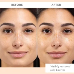Skin Remedy Barrier-Boosting Sheet Mask