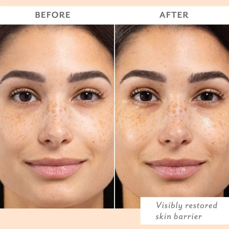 Skin Remedy Barrier-Boosting Sheet Mask