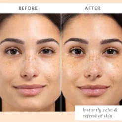 Skin Remedy Calm & Protect Mist