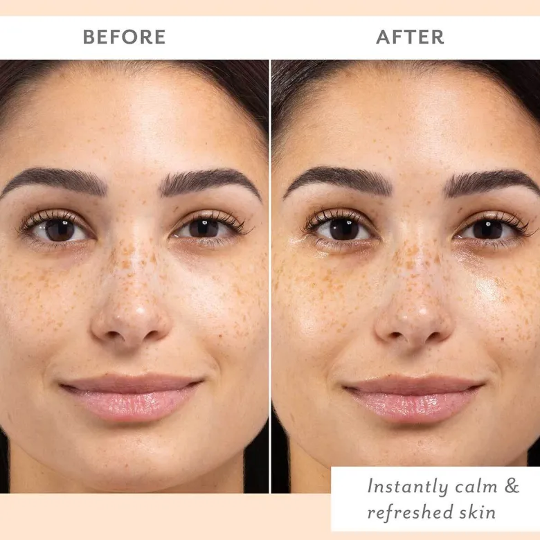 Skin Remedy Calm & Protect Mist