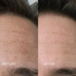 Skin Reset Face Serum