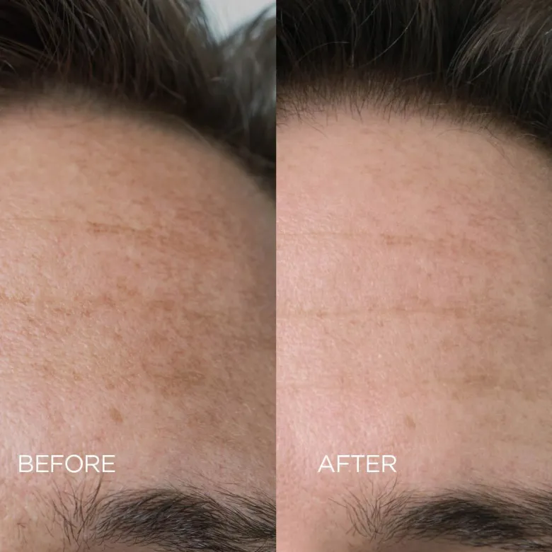 Skin Reset Face Serum