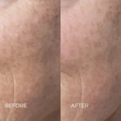 Skin Reset Face Serum