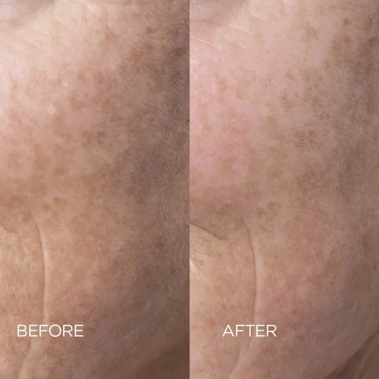Skin Reset Face Serum