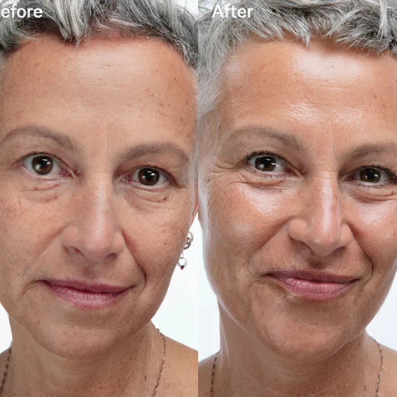 SUNSHINE OIL RELAUNCH - VITAMIN C + SQUALANE