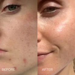 Supernatural Blemish Serum