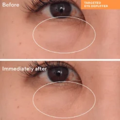 Targeted Eye Depuffer