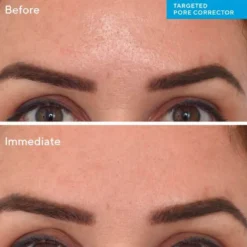 Targeted Pore Corrector