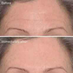Targeted Wrinkle Corrector