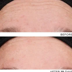 The Exceptional RetiNAD+ Renewal Booster