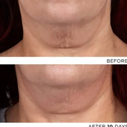 The Exceptional RetiNAD+ Renewal Booster
