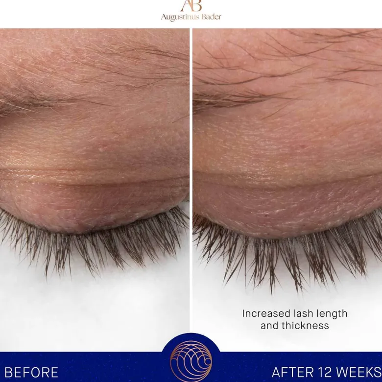 THE EYEBROW & LASH ENHANCING SERUM