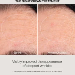 The Night Cream Treatment
