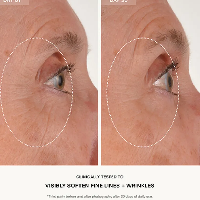 The RETURN Eye Concentrate