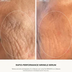 The SMOOTH Dynamic Wrinkle Defense Serum
