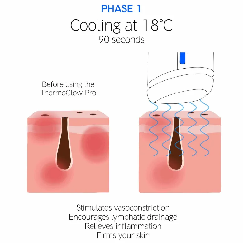 The ThermoGlow Pro