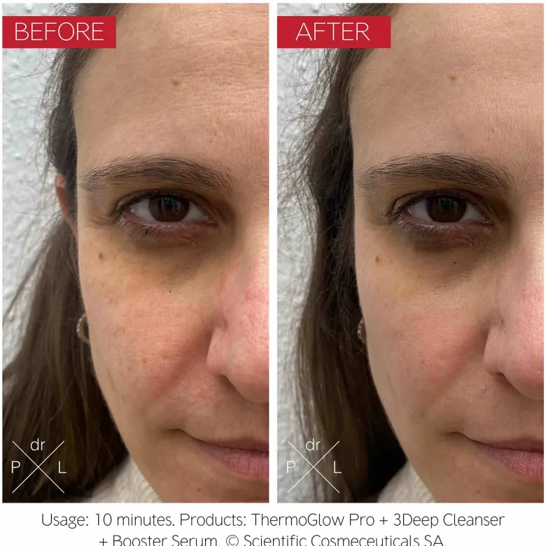 The ThermoGlow Pro