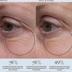 Tightening Eye Gel