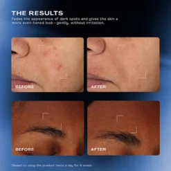 Total Clarity Dark Spot Serum