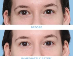 TOTAL EYE RESET 4-PAIR SET