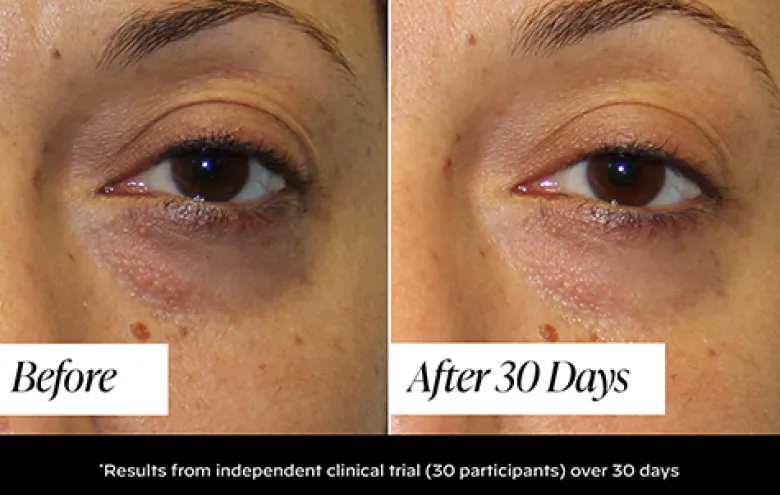 Triple Action Eye Cream