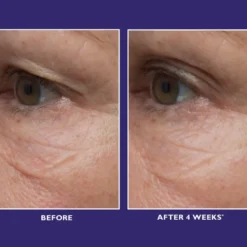 Ultimate Solution 5™ Multitasking Eye Cream