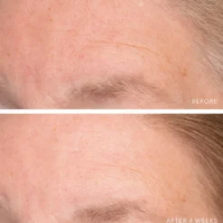 Ultra Hydrating Serum