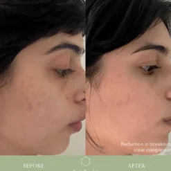 VITABIOME™ ACTIVE SKIN OPTIMIZER