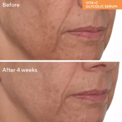Vita-C Glycolic Brightening Serum