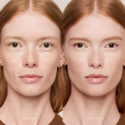 Vital Skincare Concealer