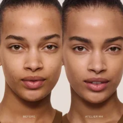 Vital Skincare Concealer