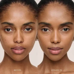 Vital Skincare Concealer