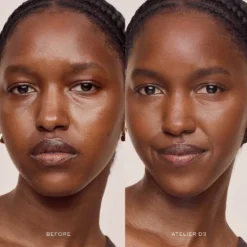 Vital Skincare Concealer
