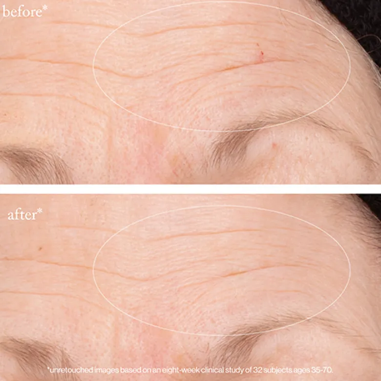 3x Retinol Regenerative Serum