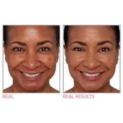 Your Skin But Better Foundation + Skincare